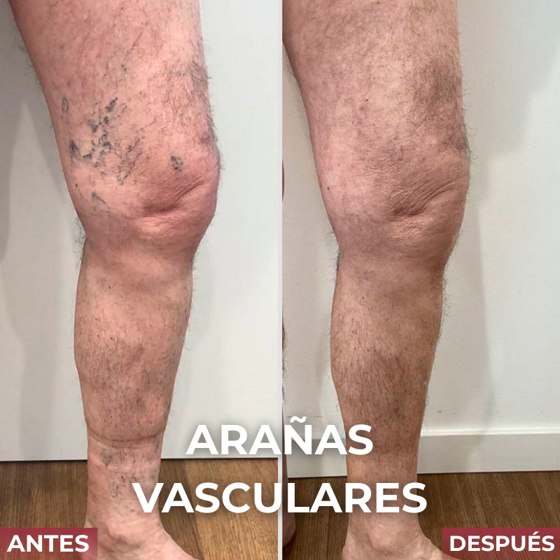 VELTRIX™ Suplemento Para La Circulación