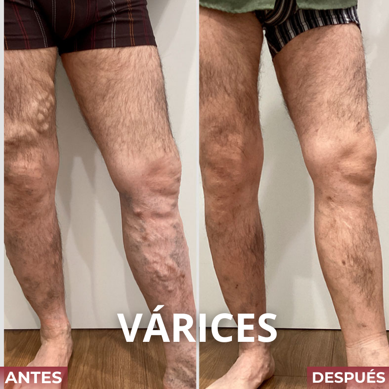 VELTRIX™ Suplemento Para La Circulación