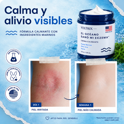 Veltrix™ Crema Intensiva Para Eczema