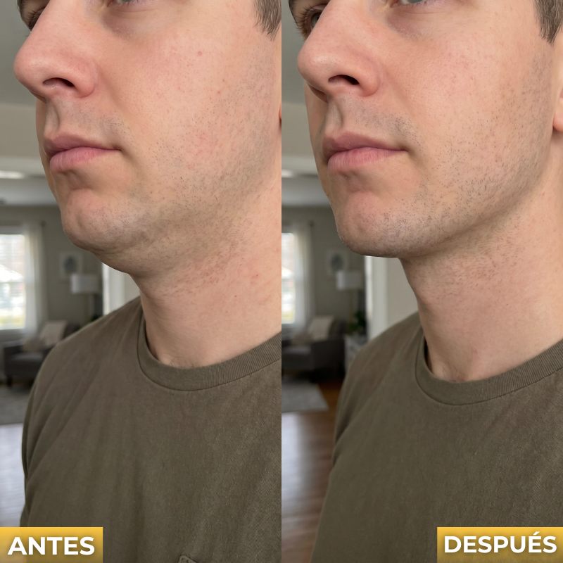 Veltrix™ Crema Reafirmante Para El Cuello