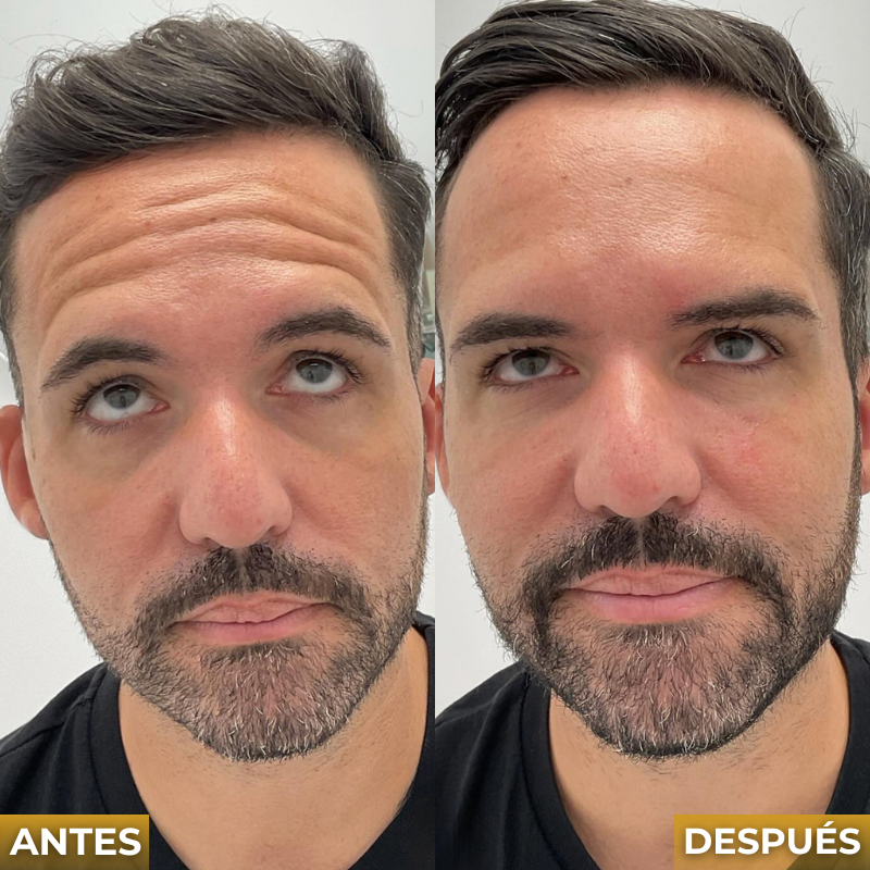 Veltrix™ Sérum Facial Intensivo Antiarrugas