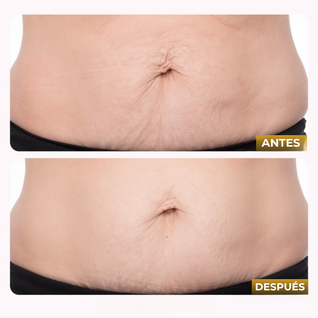Veltrix™ Aceite Intensivo Reafirmante