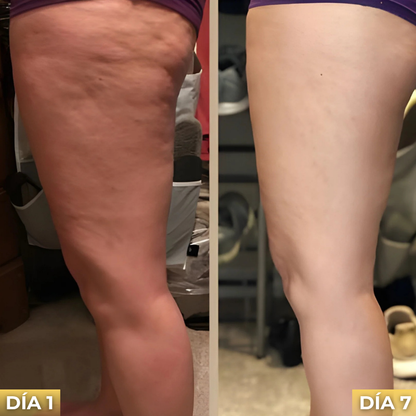 Veltrix™ Aceite Intensivo Anticelulitis Reafirmante
